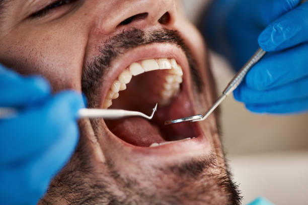 Best Broken or Cracked Tooth Emergency Dentist in Lykens, PA