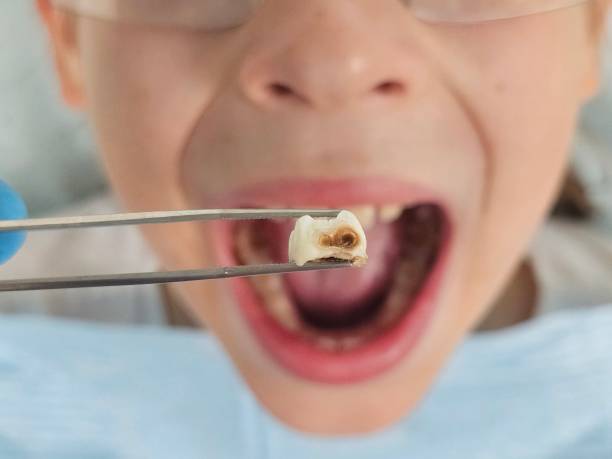 Best Emergency Dentist for Knocked-Out Tooth in Lykens, PA