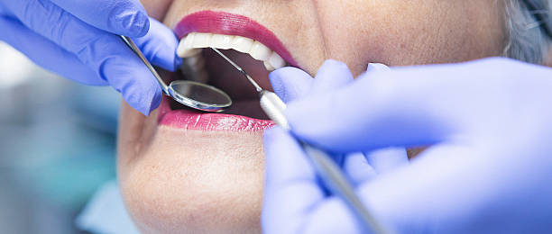Best Emergency Dental Extractions in Lykens, PA